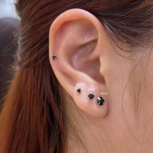 Topos y Aretes
